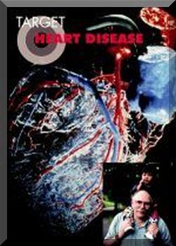 Target heart disease