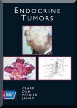 Atlas of Clinical Oncology. Endocrine Tumors
